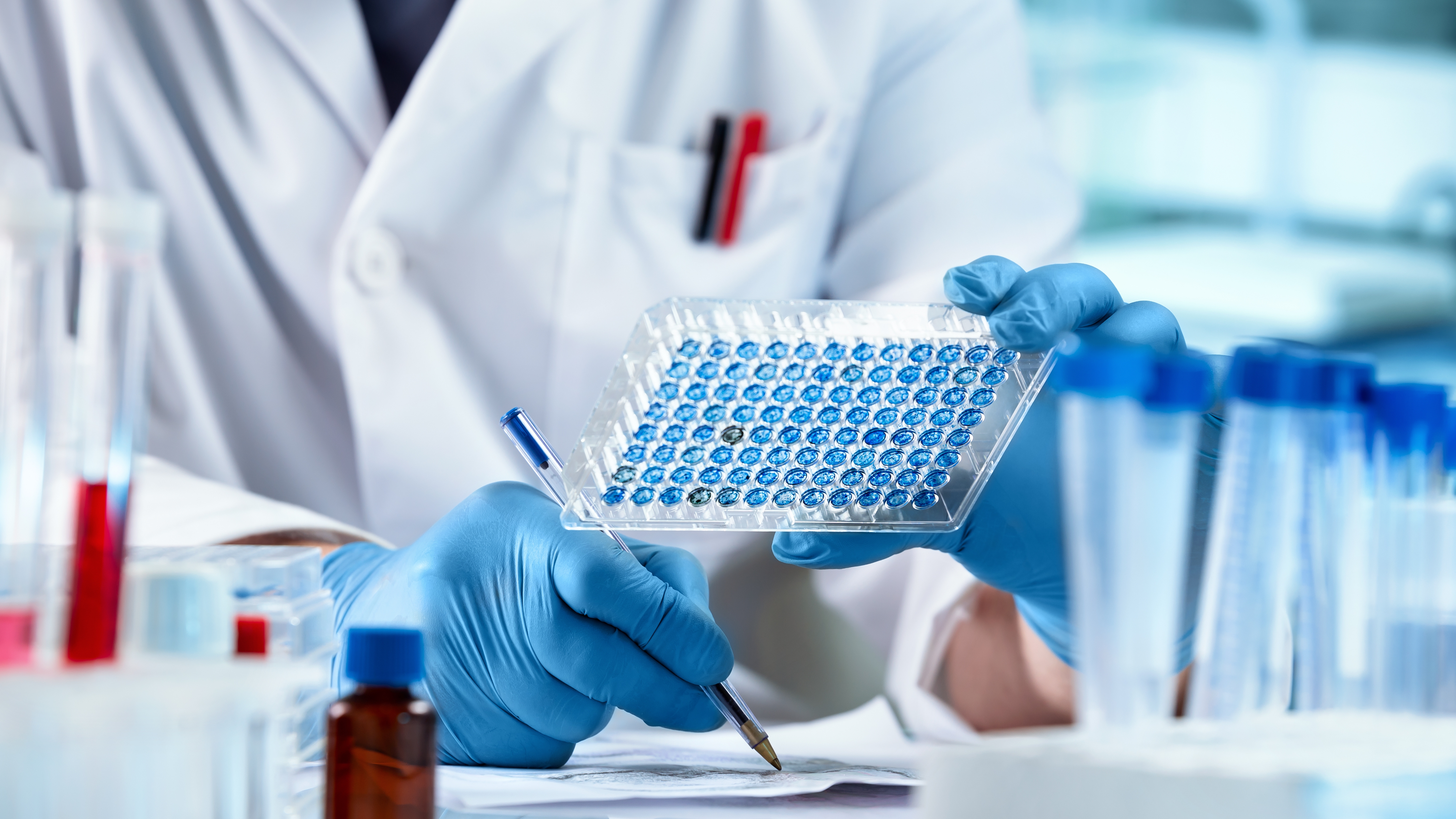 Scientist looking at samples panel microplate and writing down the data result of ELISA analysis